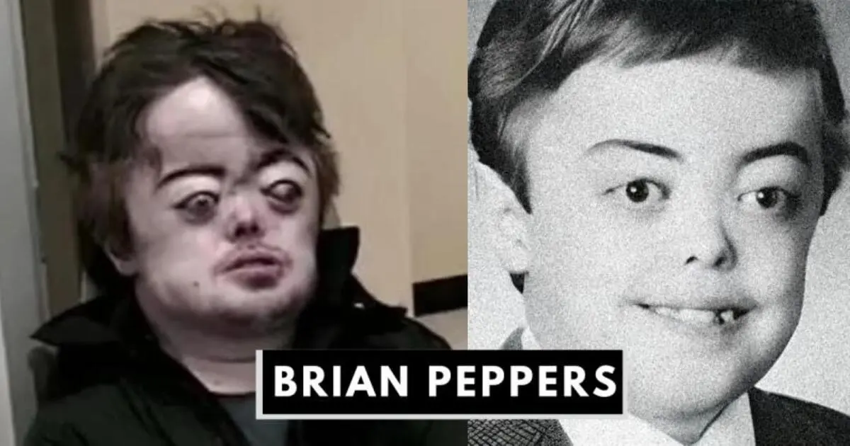 Who was Brian Peppers? | His Life, Struggles, and Legacy
